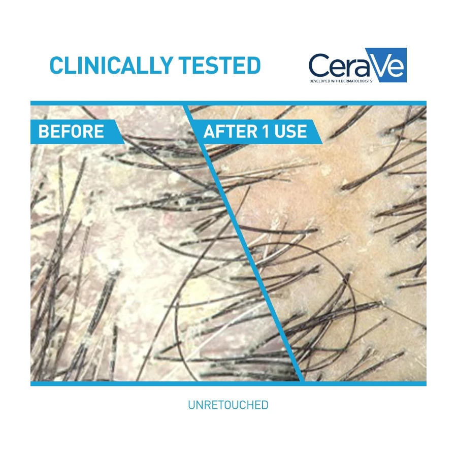 CeraVe Anti-Dandruff Hydrating Shampoo for Men & Women, Gently Cleanses Scalp & Hair While Reducing Flakes