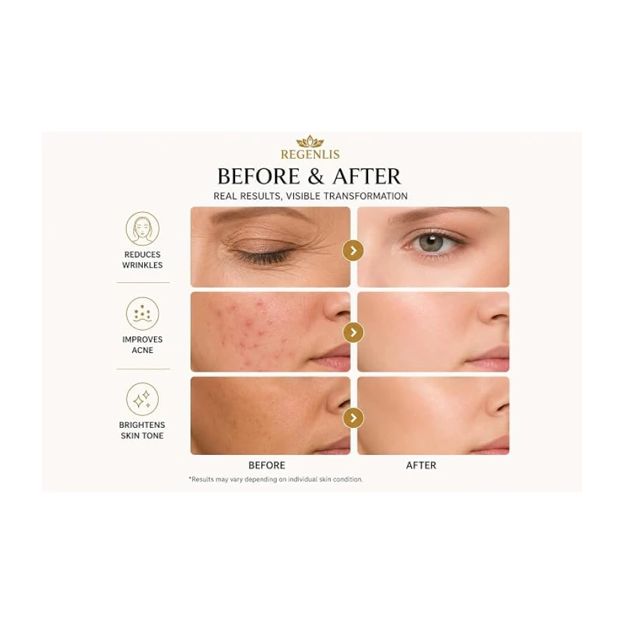 Mascarilla LED Cara y Cuello – Dispositivo de Fototerapia de 7 colores, Cuidado antienvejecimiento, ayuda a reducir la apariencia de las arrugas, mejora el brillo de la piel, uso en el hogar