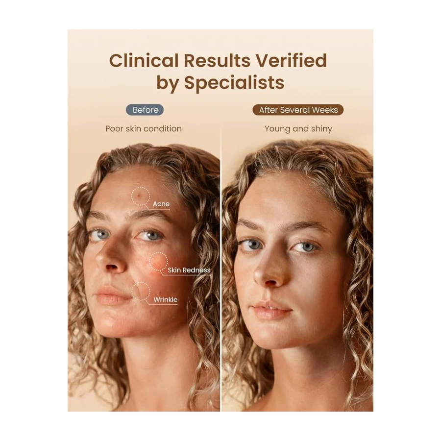 Máscara facial LED RENPHO con 324 LED, 630nm & 850nm, Regalo Mujer